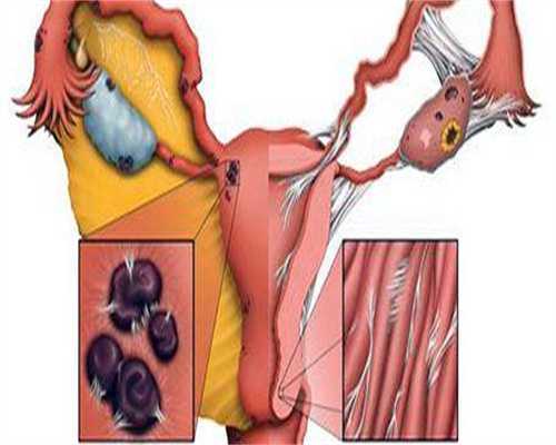 哪里有靠谱代孕,始基子宫做试管（始基子宫做试管实现生育的方法）