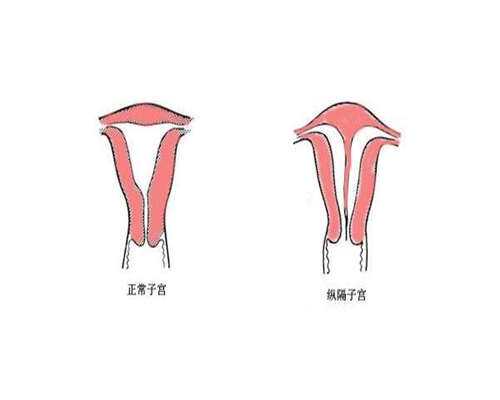 江苏联环药业叶酸片是不是活性叶酸片，吃的时候注意什么？