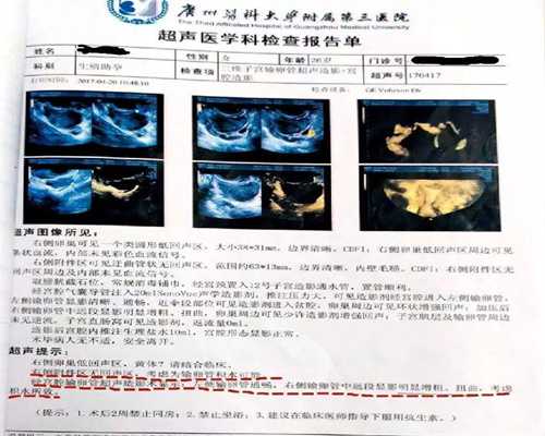 私立助孕医院:孕6周胎心胎芽正常但孕酮低怎么办
