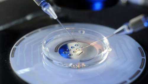 南京妇幼保健院供卵试管,江苏供卵试管医院排行南京妇幼保健院供卵试管费用