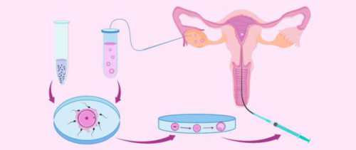 盐城哪里试管婴儿比较好？江苏盐城哪里做试管最好！